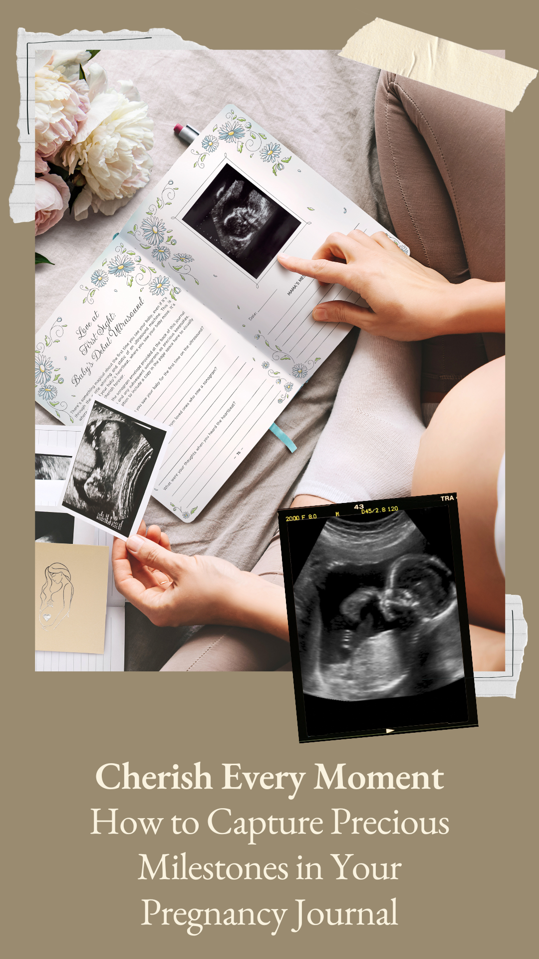 Cherish Every Moment: How to Capture Precious Milestones in Your Pregnancy Journal