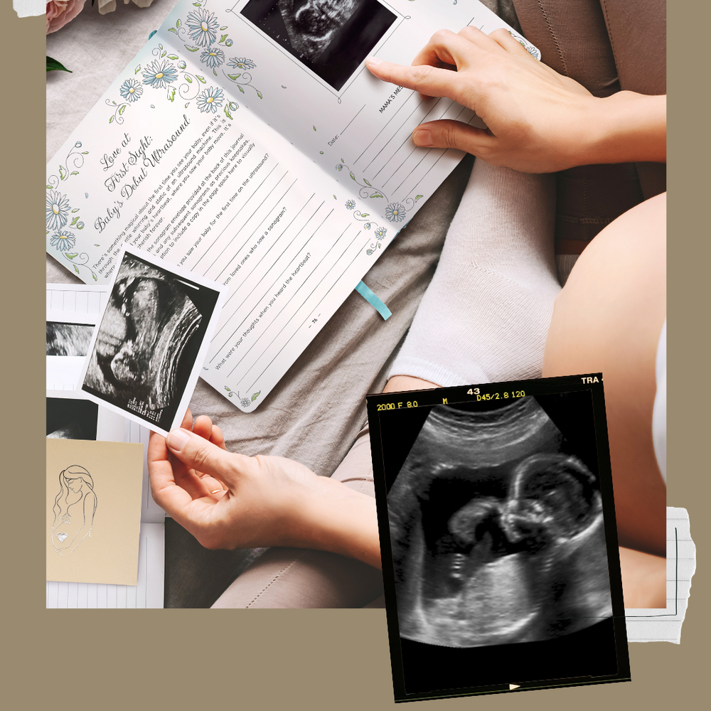Cherish Every Moment: How to Capture Precious Milestones in Your Pregnancy Journal